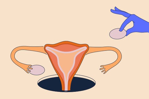 Early Menopause