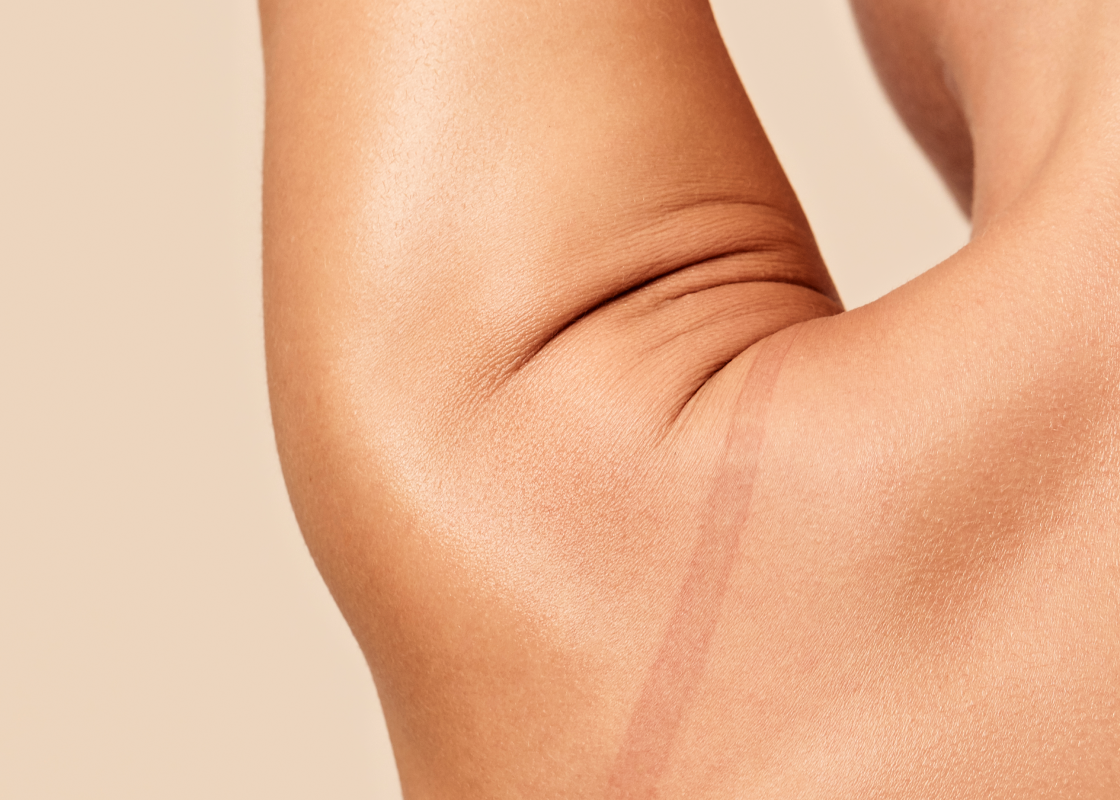 PMS and PMDD Symptoms