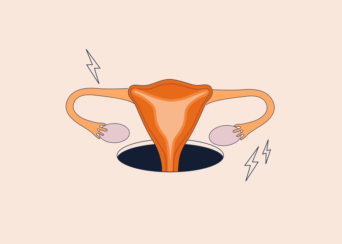 STDs Cause Infertility