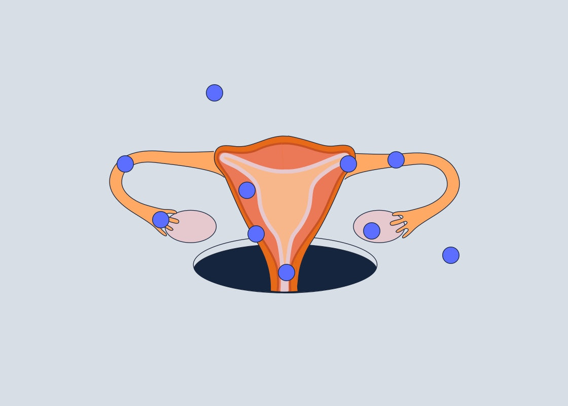 What Exactly Is An Ectopic Pregnancy?