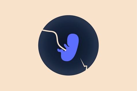 How common is miscarriage and why does it happen?